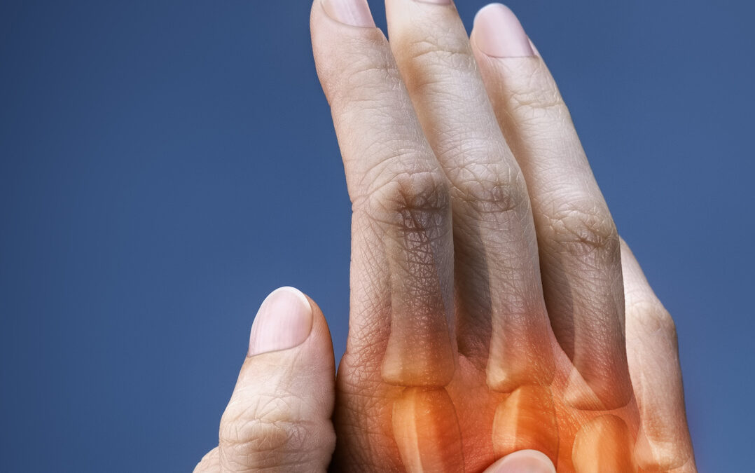 Ganzheitliche Handtherapie – Modul 4: Rheuma und Arthrose