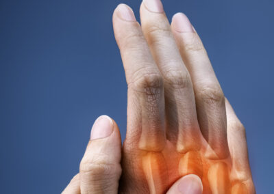 Ganzheitliche Handtherapie – Modul 4: Rheuma und Arthrose