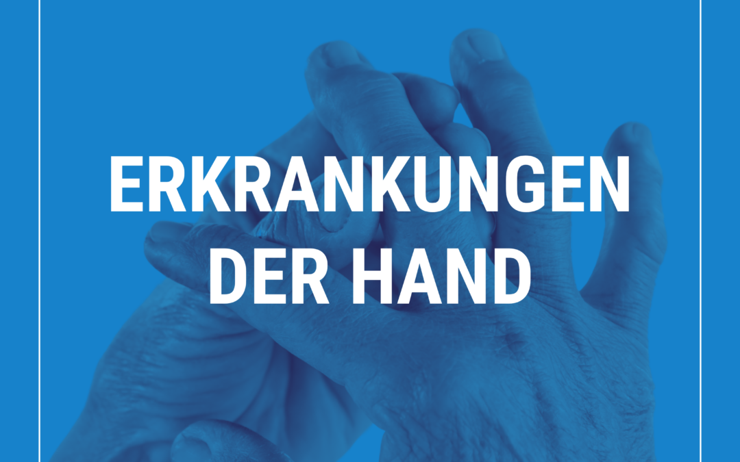 Erkrankungen der Hand – am 14.12.2024 mit Lina Bücker